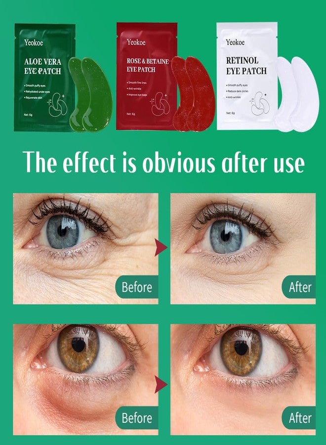 Yeokoe Under Eye Patches For Puffy Eyes and Dark Circles Wrinkle,30 Pairs Face Masks SkinCare With Retinol Serum,Aloe Vera,Rose Betaine - Image 4